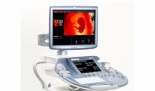 GE HealthCare Voluson E8